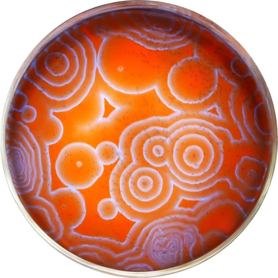 recommendation image