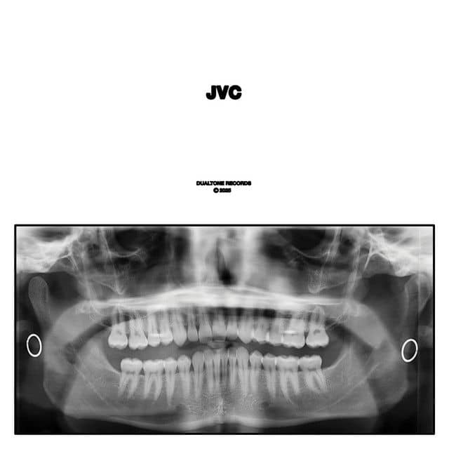 recommendation image