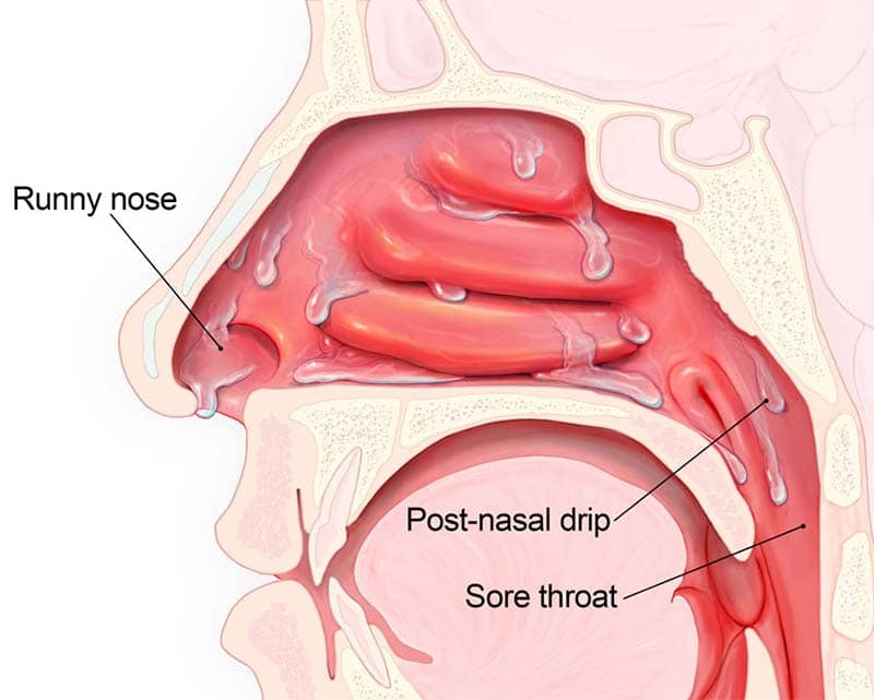 recommendation image