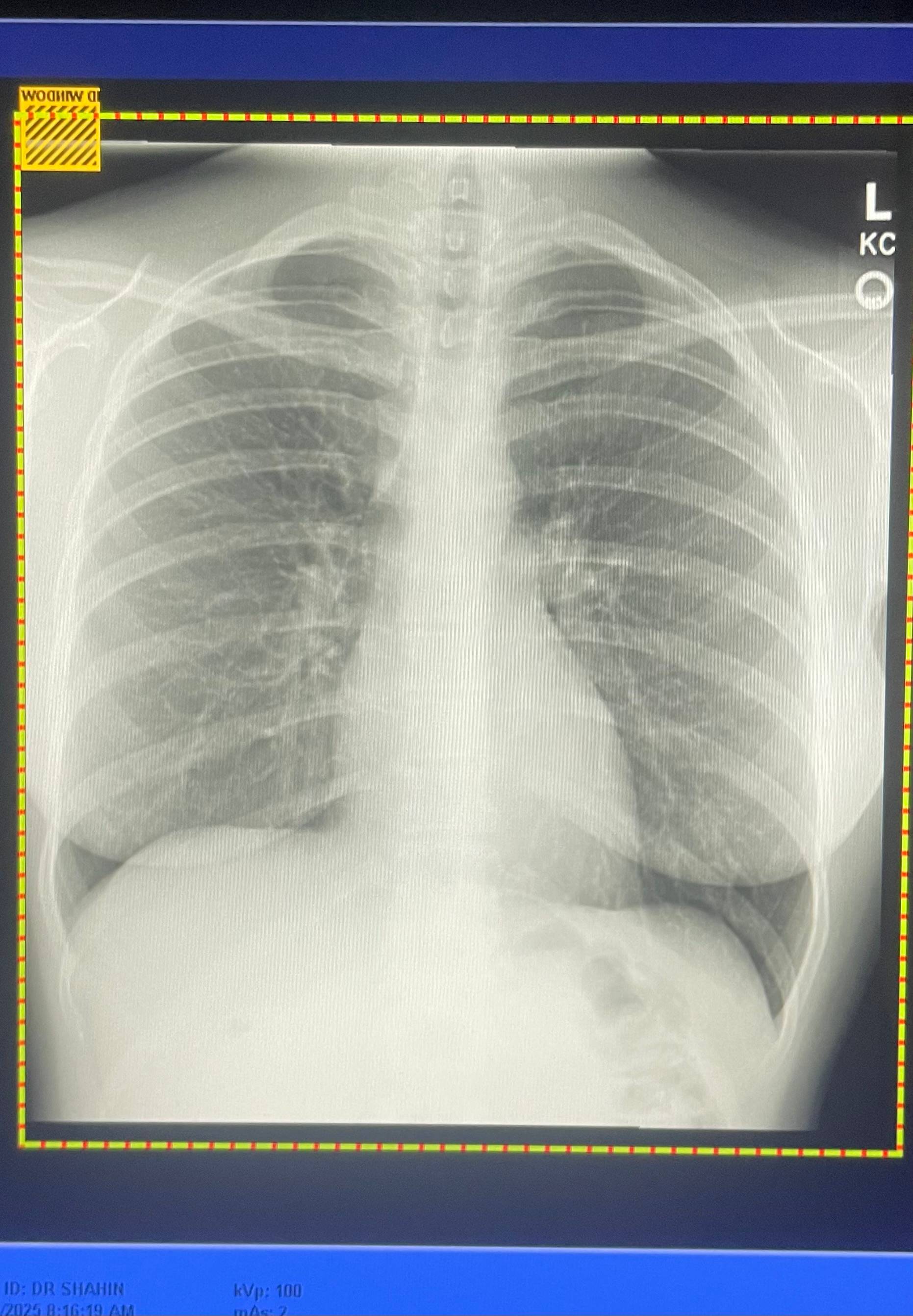 recommendation image